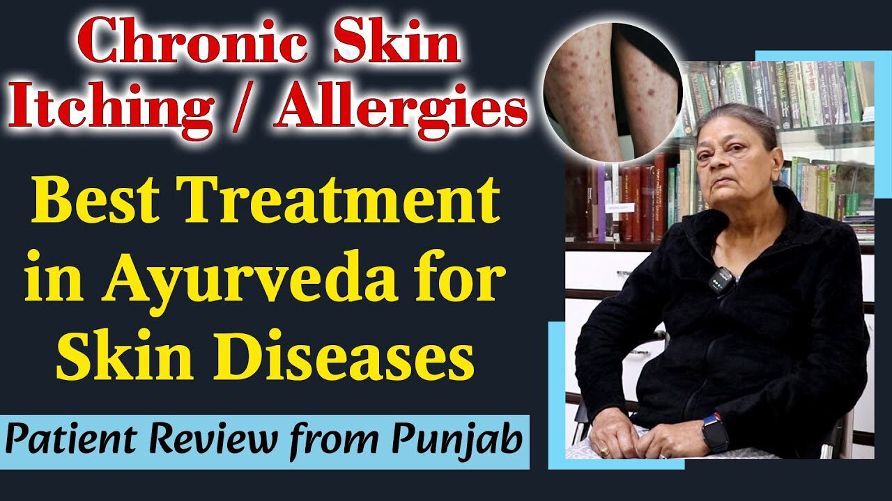 Chronic Skin Itching/ Allergy, Skin Diseases- Best Treatment in Ayurveda