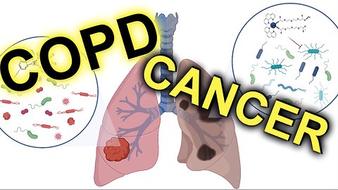 Harnessing Natural Power: Aiding Cancer & COPD Management