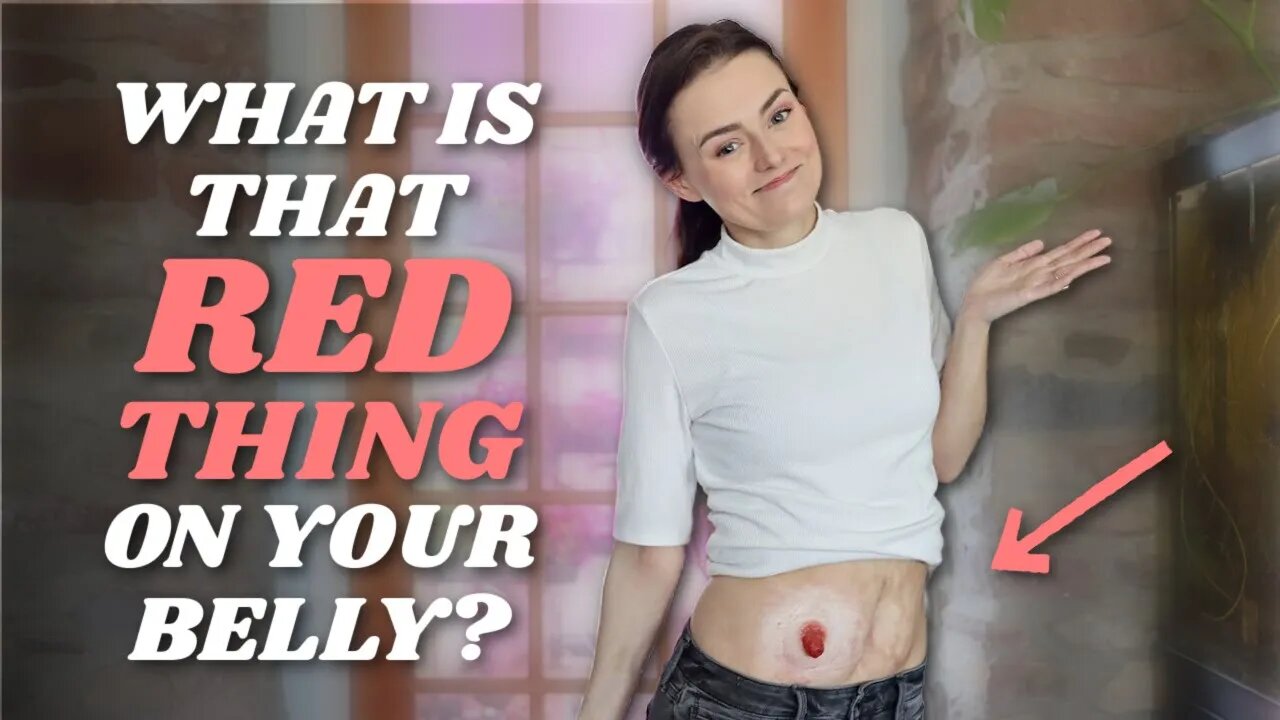 What is a Stoma / Ostomy? (That Red Thing Hanging Out of My Belly!) | Let's Talk IBD