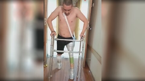 Russian Crippled Occupiers Receive Free Prosthetics Made from Plastic Bottles