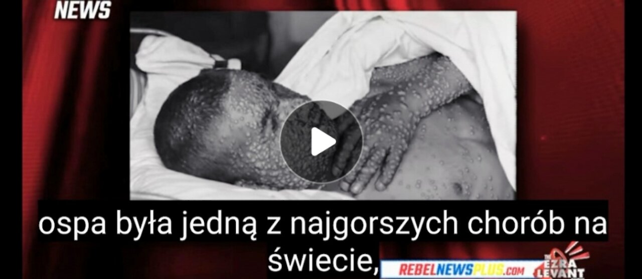 Następna planowana epidemia to - OSPA?