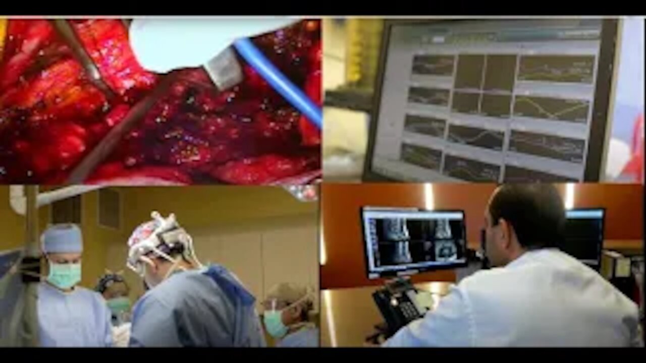 Spinal Fusion: Recovery A Year Later