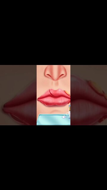 asmr lips shoulder injury treatment subscribe plz