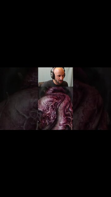 The future of surgery but you've still got to pay - Scorn