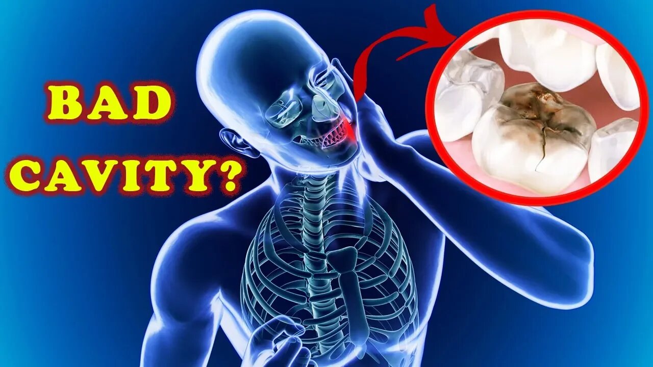 How To REVERSE CAVITIES for Free?! The Holistic Way