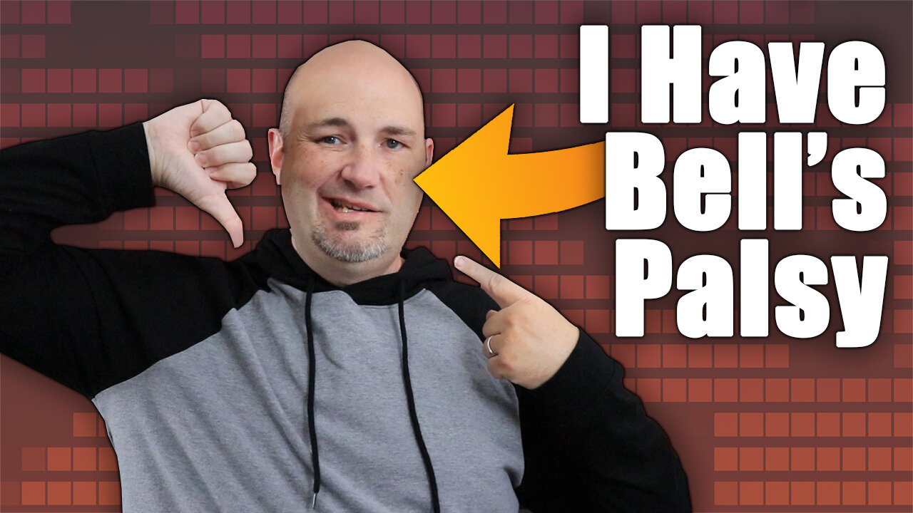 Health Update - I have Bells Palsy - What It Is & My Recovery Plans