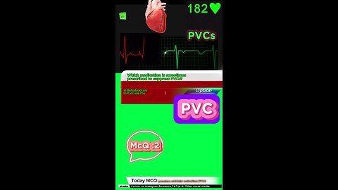 PVC #pvc #arrthymias #cardaic #heart prematureventricle tachycardia