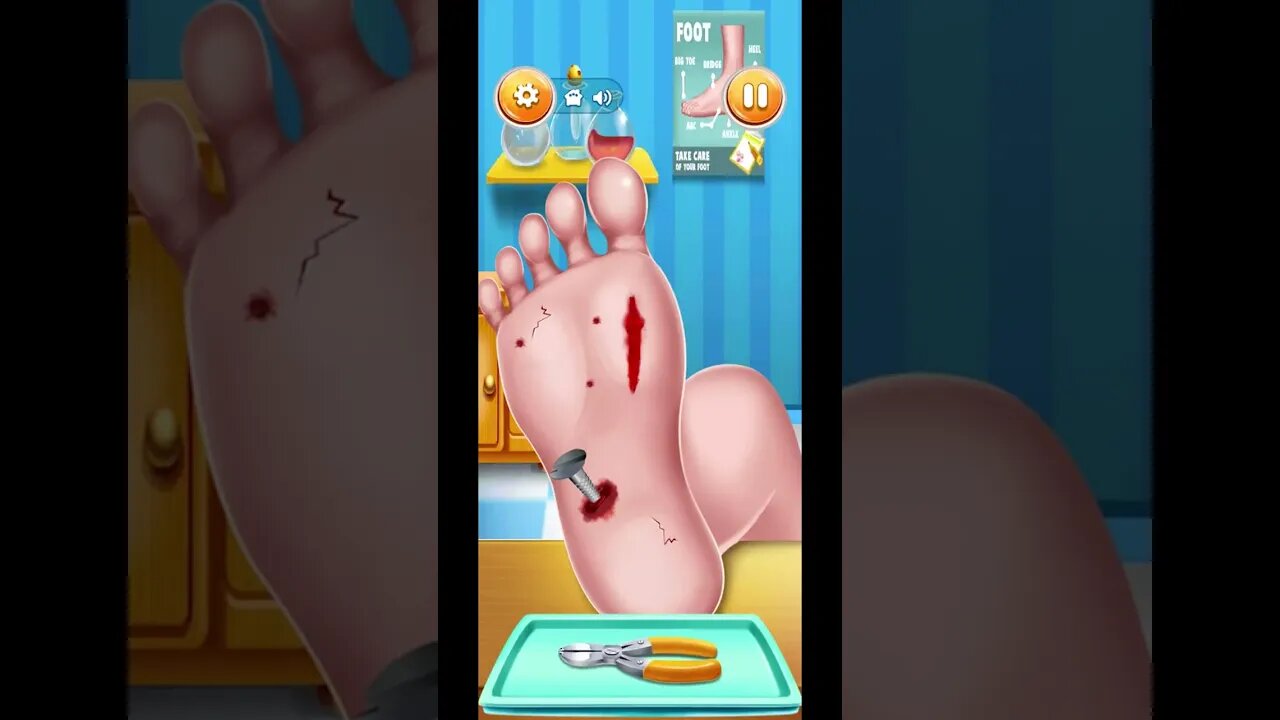 foot doctor care | Foot Surgery Doctor Gameplay Walkthrough | Lazoo games