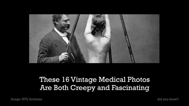 These 16 Vintage Medical Photos Are Both Creepy and Fascinating