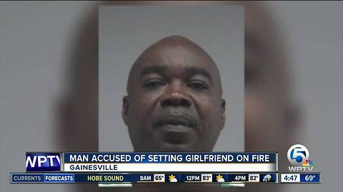Florida man accused of setting girlfriend on fire