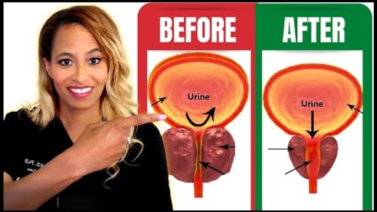 The #1 Important All-Natural Way to Shrink the Prostate Dr Rachael