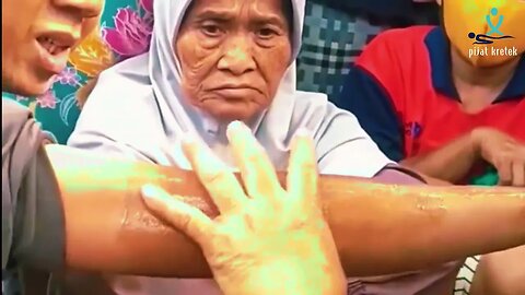 Pengobatan Ibu Ida Dayak, pengobatan tradisional minyak bintang