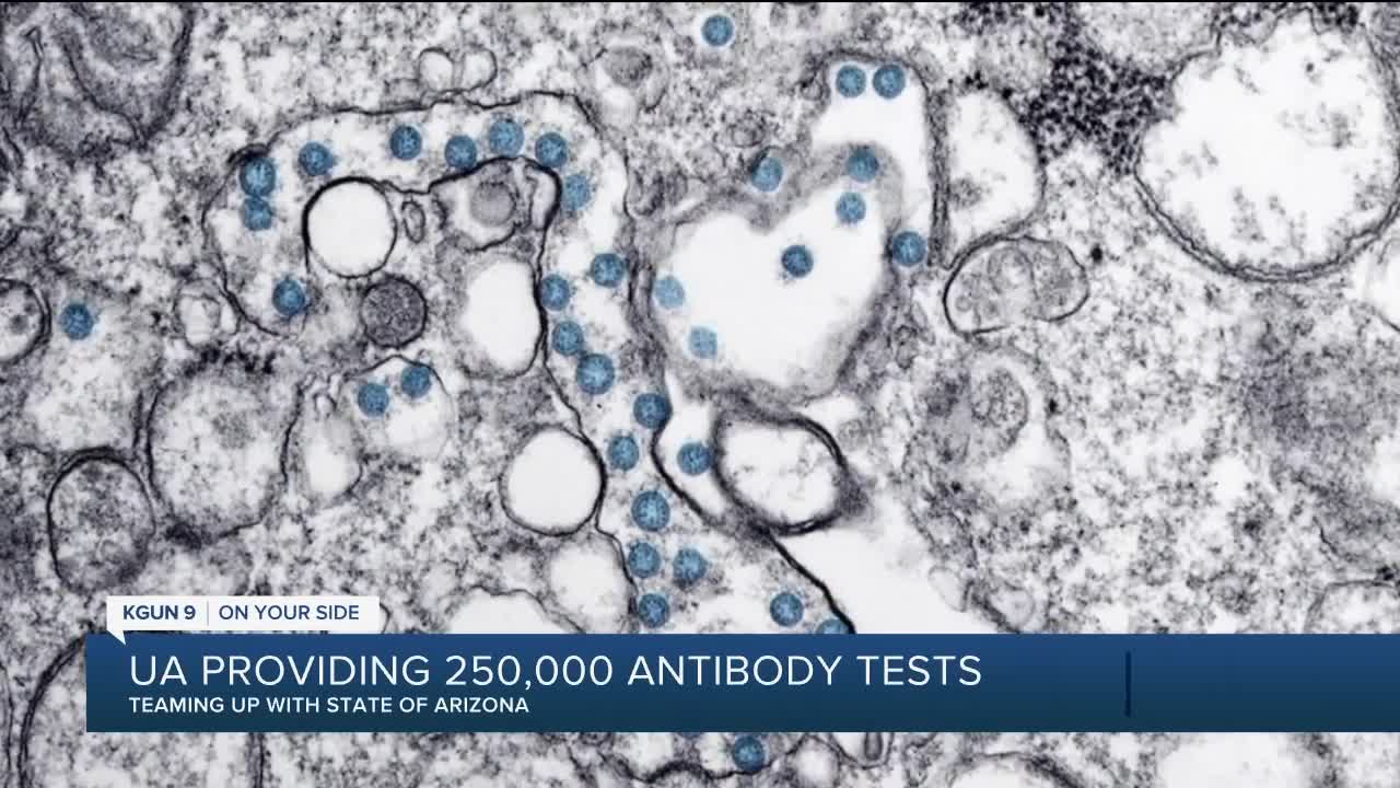 UArizona making COVID-19 antibody tests for first responders, health care workers