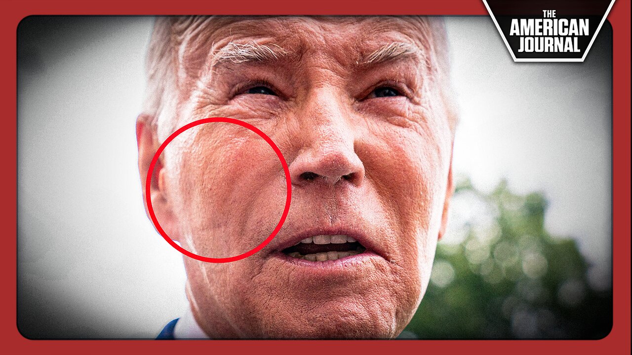 Bizarre Marks On Biden’s Face Leave Americans Questioning His Private Activities