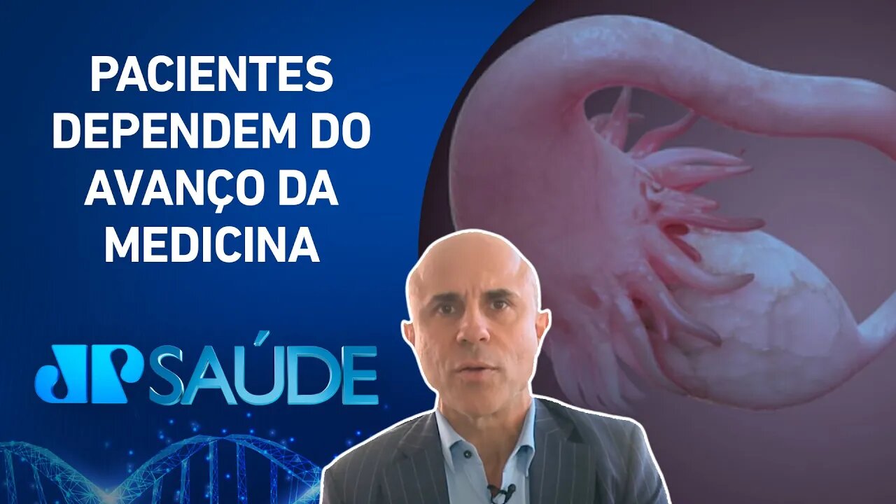 “Câncer de ovário é o tumor feminino mais perigoso”, diz especialista | Dr. Fernando Maluf
