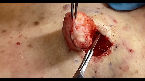 Would you pass this medical resident quiz?