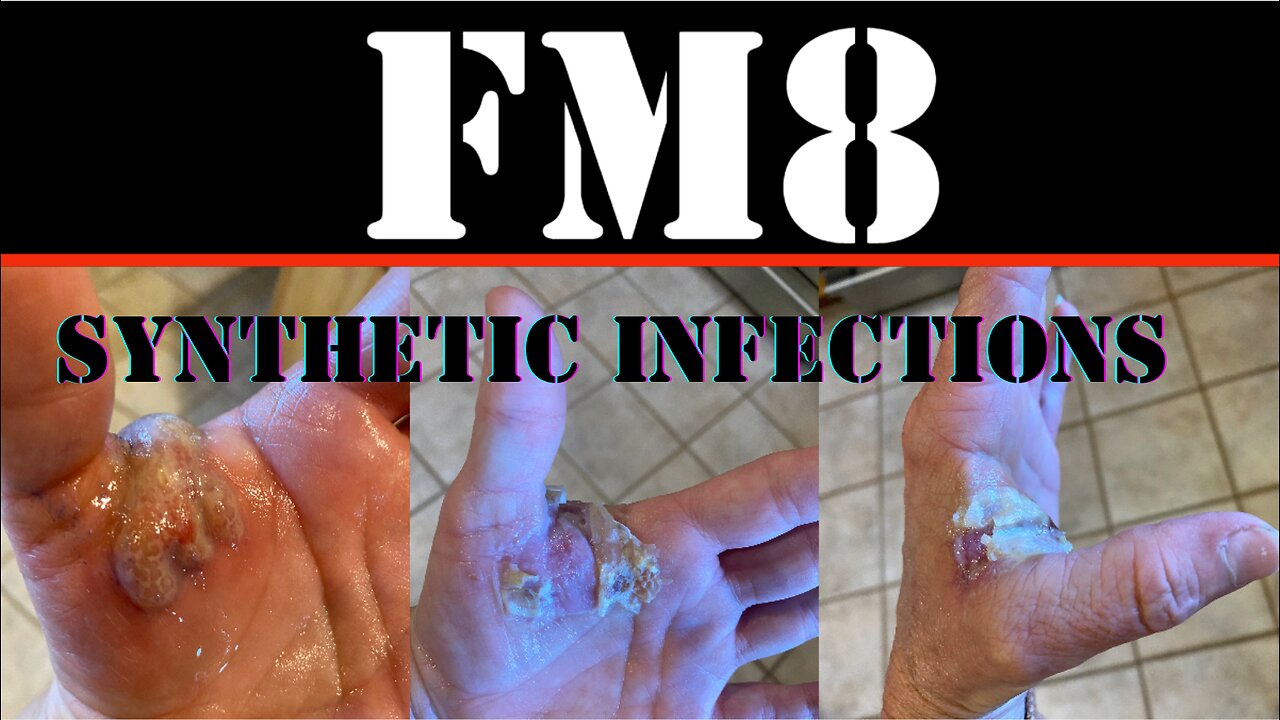 FM8 - POSSIBLE SYNTHETIC INFECTION