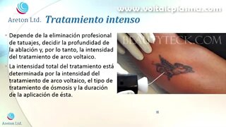 ESTUDIO DE ELIMINACIÓN DE TATUAJES ACTO III