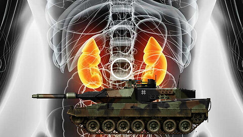 UKRAINE - Tanks for Kidneys