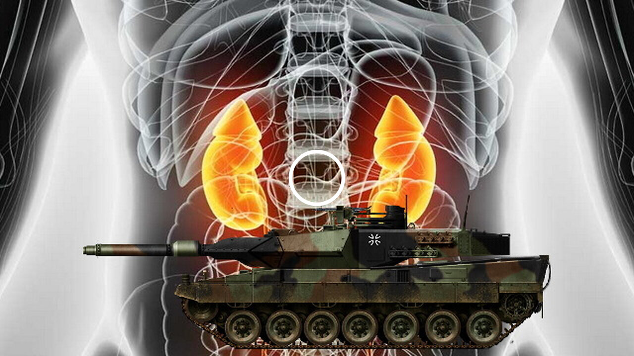 UKRAINE - Tanks for Kidneys