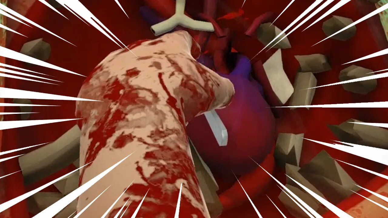 Let's Do This For Real (Surgeon Simulator: Heart Transplant)