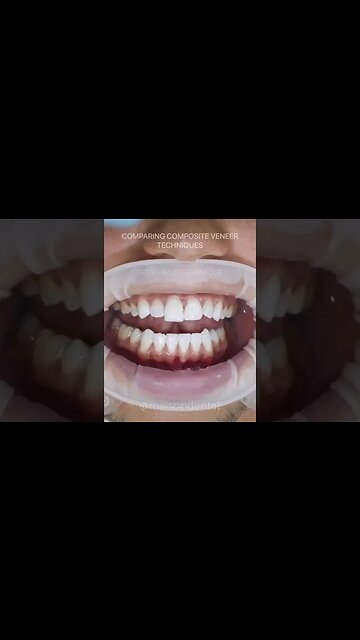 Dental And Teeth Hygiene