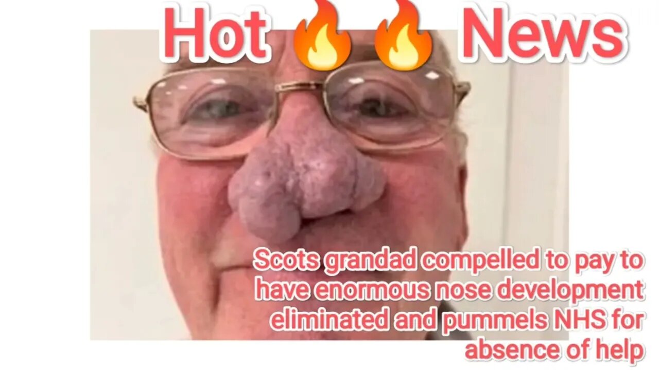 Scots grandad compelled to pay to have enormous nose development eliminated and pummels NHS for