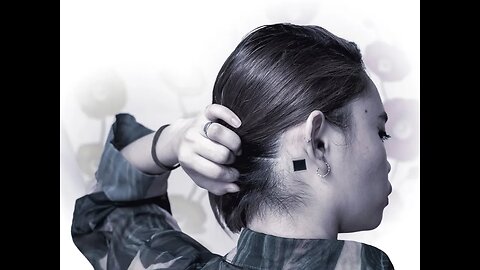 Neuralink looking for volunteers