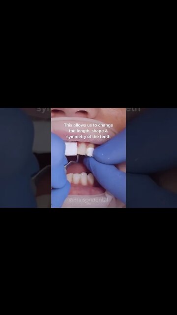 Dental And Teeth Hygiene