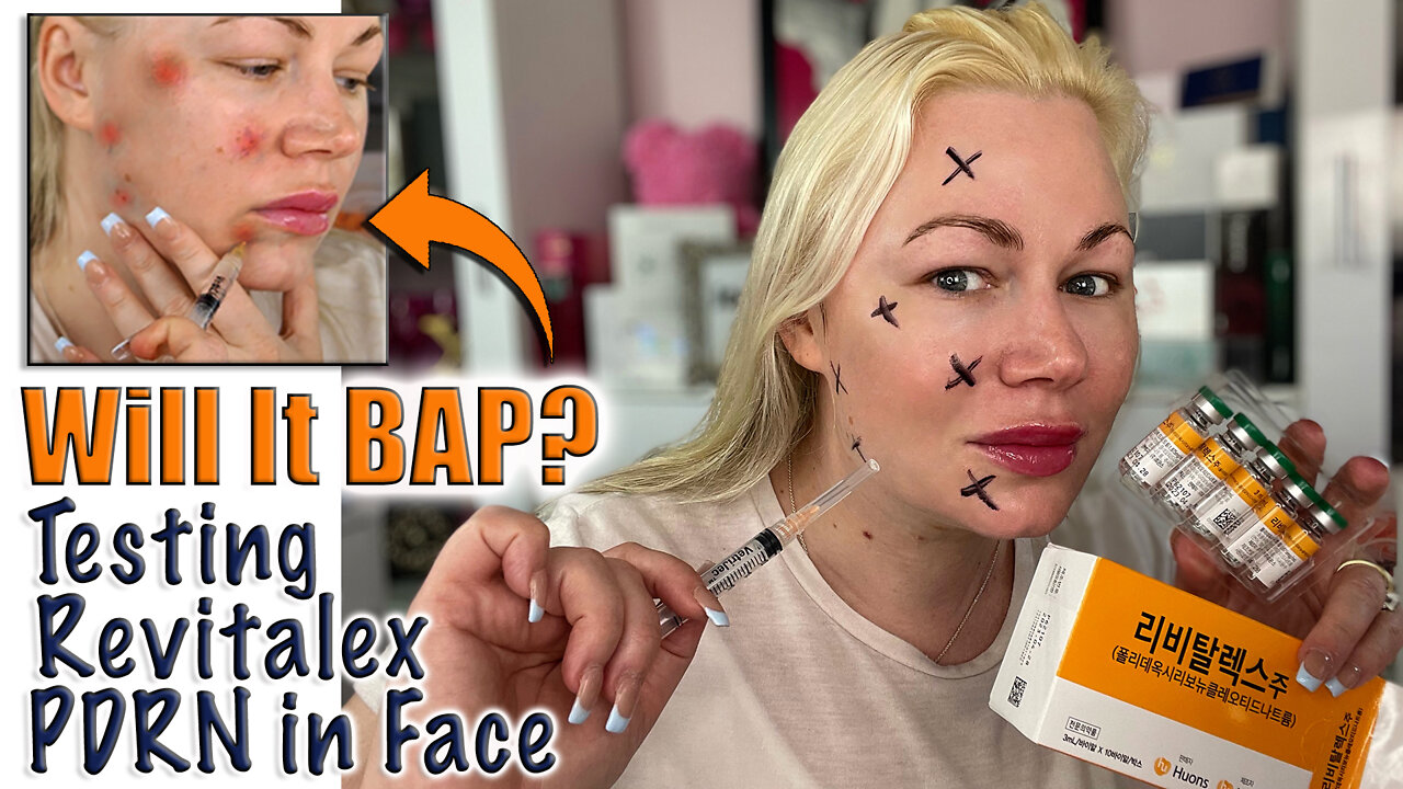 Will It BAP? Testing Revitalex Pdrn meso in Face from Celestapro.com | Code Jessica10 Saves Money $$