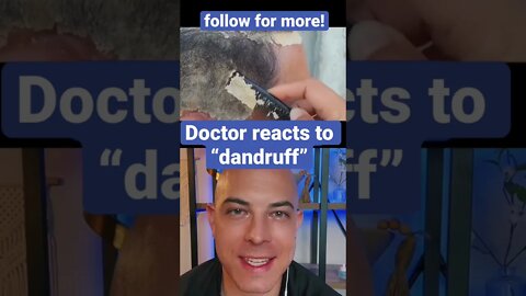 Derm reacts to crazy overflowing dandruff!