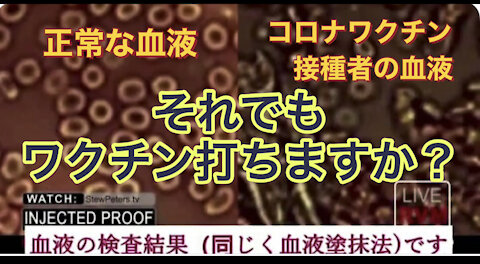 世界初？ ワクチン接種者必見!!! 海外でコロナワクチンの中身が報道されました