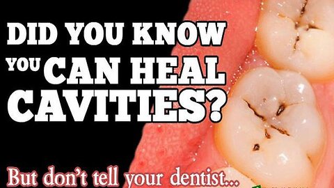 UNBELIEVABLE BUT TRUE – HERE IS HOW YOU CAN HEAL CAVITIES IN A NATURAL WAY