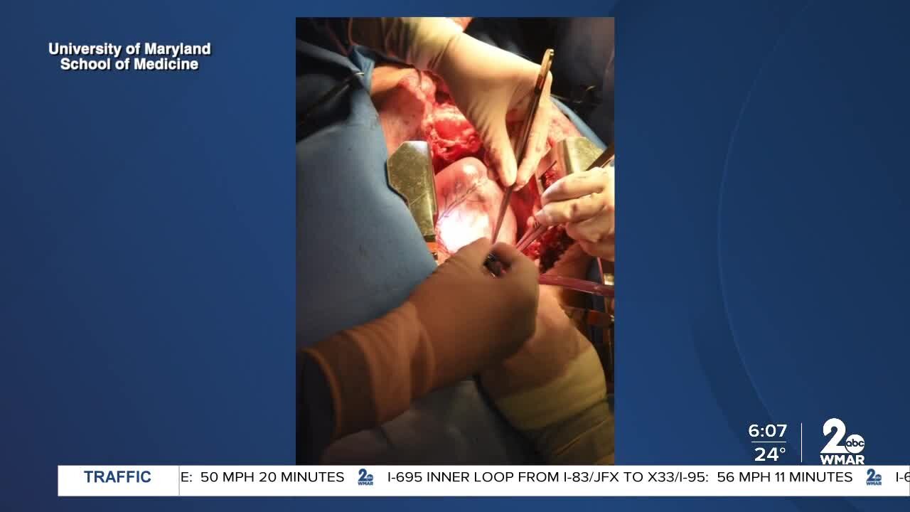 First ever pig-to-human heart transplant