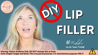 I Tried DIY Lip Fillers: What Went Wrong?