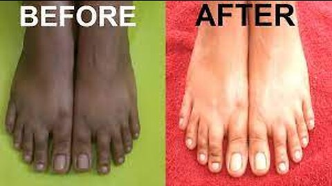 😲 Amazing Feet Cleaning/Tanning Remove Tips ll #skincaretips #tanremove #ytshorts #shortvideo
