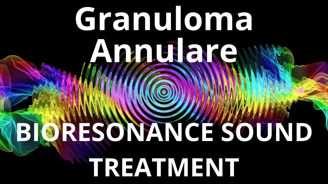 Granuloma Annulare _ Sound therapy session _ Sounds of nature