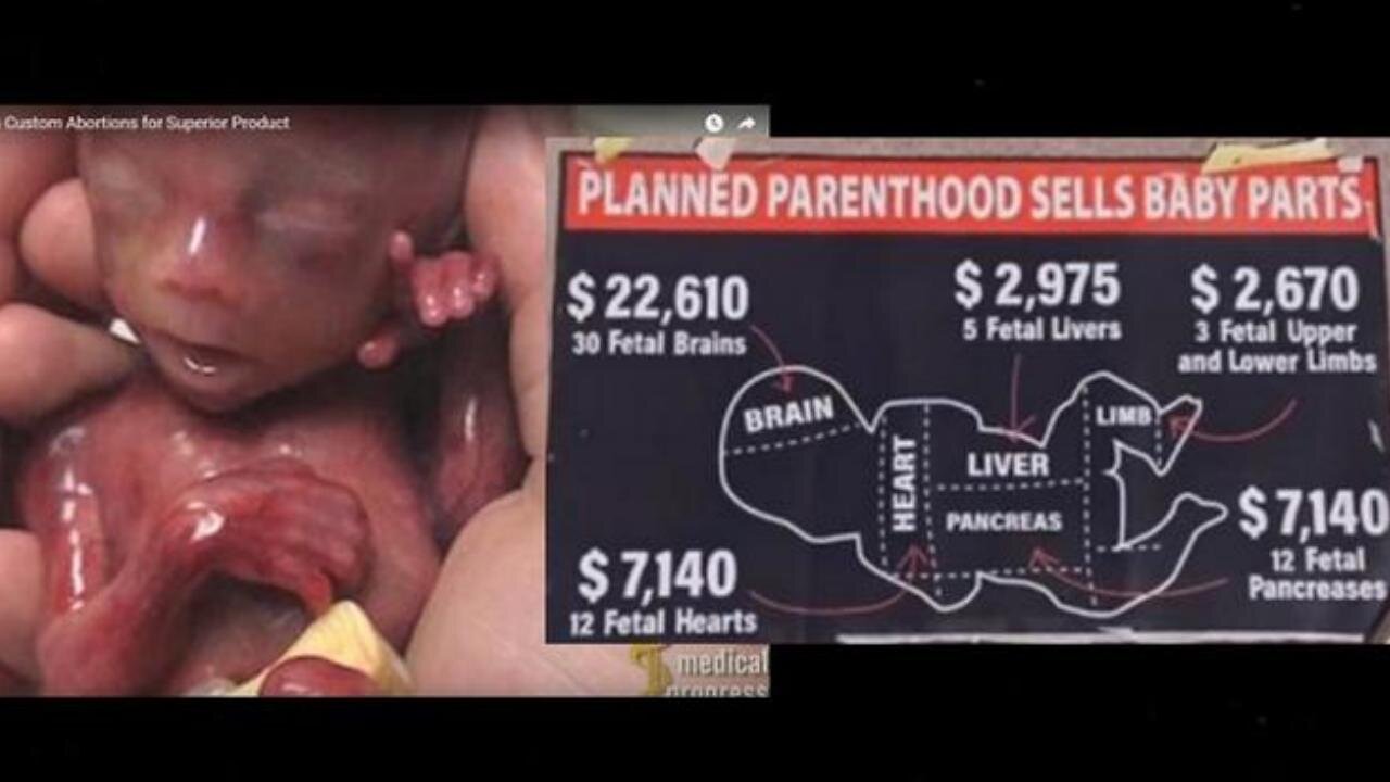Planned Parenthood Selling Adrenochrome Baby Parts: Organ Harvesting, Trafficking