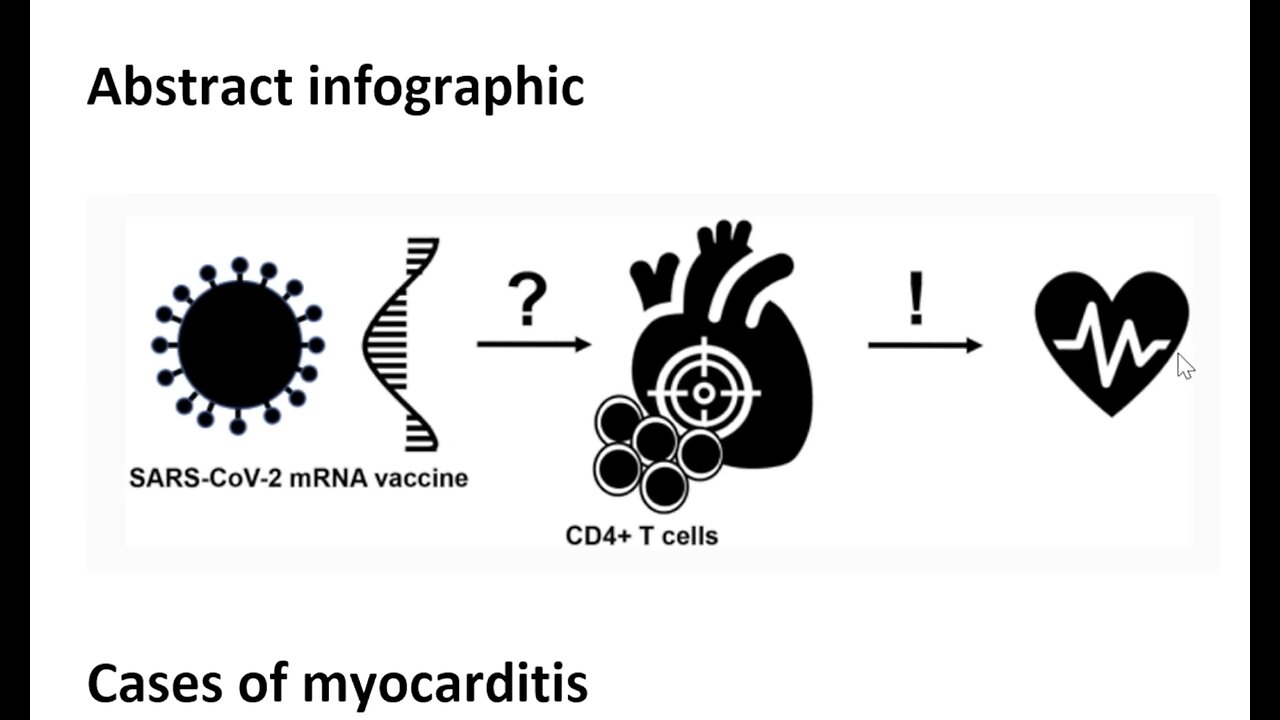 Dr.John Campbell: Autopsy-based histopathological characterization of myocarditis after COVID shot