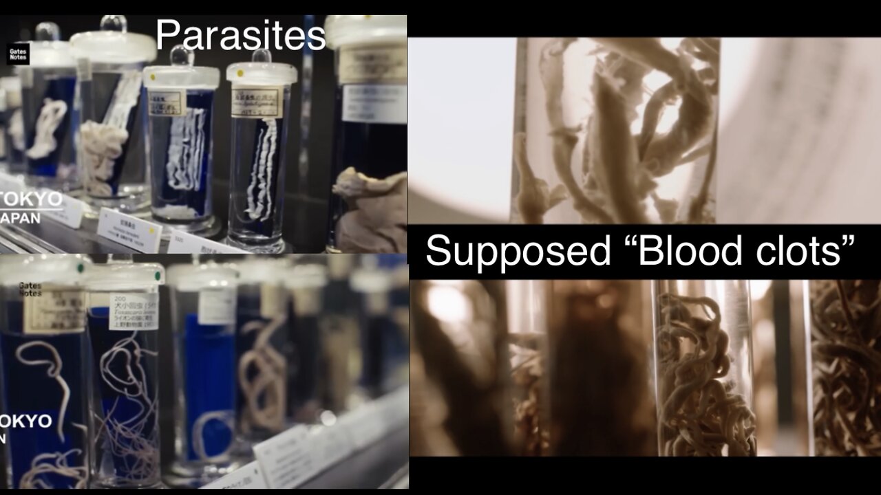 Bill Gates: Parasites and supposed blood clots