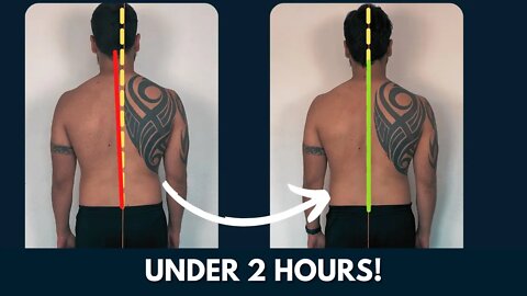posture analysis 2