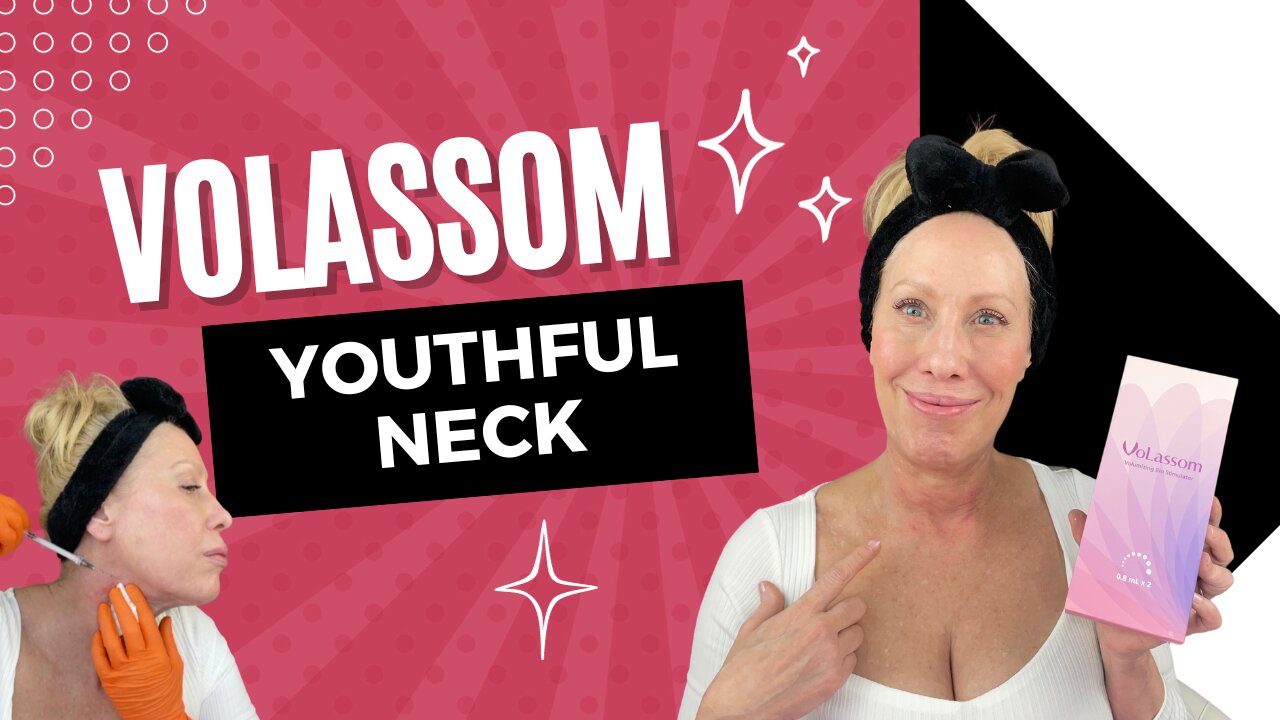 Volassom CaHA for a Youthful Neck