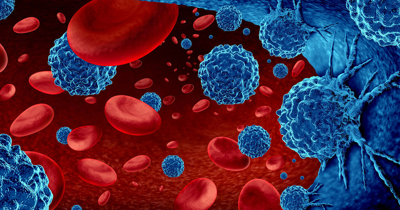 How to Prevent Leukemia