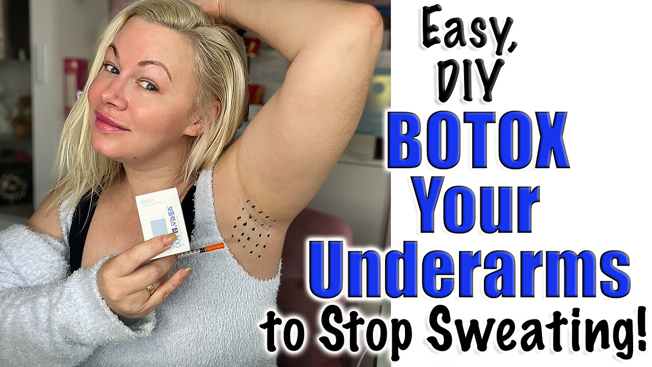 Stop Sweating with Botox in your Underarms w/ Botulax from Acecosm | Code Jessica10 Saves you Money!