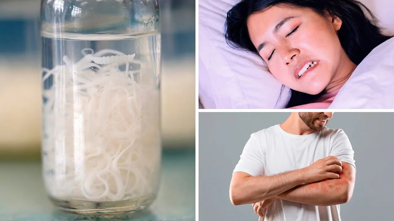 10 Signs That Someone Needs a Parasite Cleansing