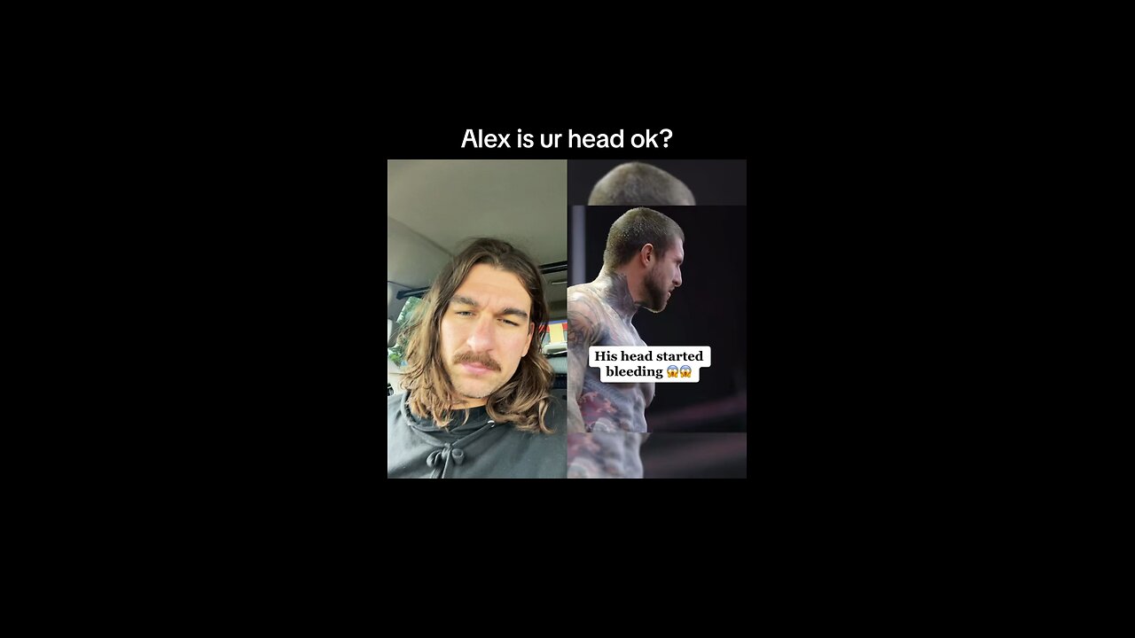 Alex Terrible Bashes Head #alexterrible