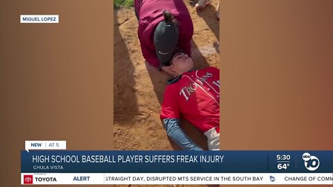 Chula Vista high school baseball player suffers freak injury