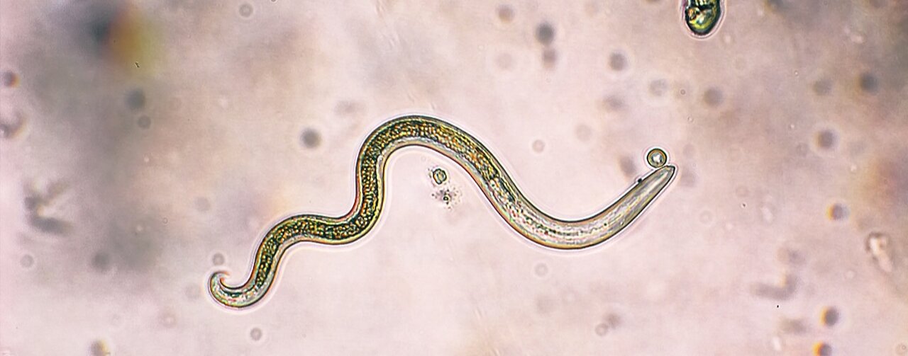 How to kill parasites and worms naturally in the body