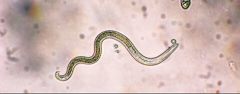 How to kill parasites and worms naturally in the body