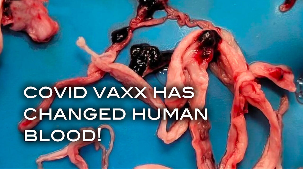 Covid Vaxx Has Changed Human Blood!